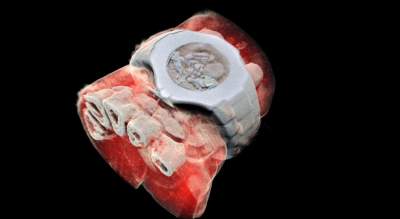 Ученые показали первые первые снимки тканей человека на цветном рентгене
