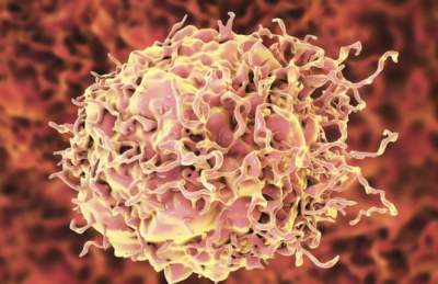 Ученые научились убивать раковые клетки, лишая их питания
